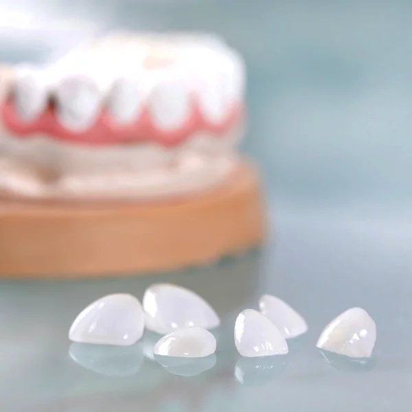 Clinica Minutilli | Protesi dentali estetiche